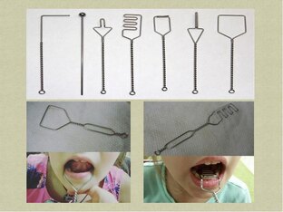 Нарушения речи их коррекция у лиц с ОВЗ