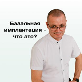 Все о базальной имплантации