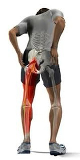 СЕДАЛИЩНЫЙ НЕРВ