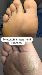 Мужской педикюр 