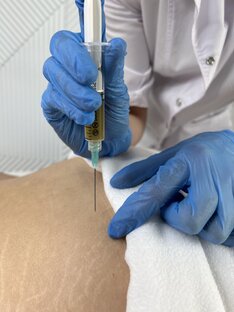 Неврология