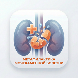 Метафилактика мочекаменной болезни