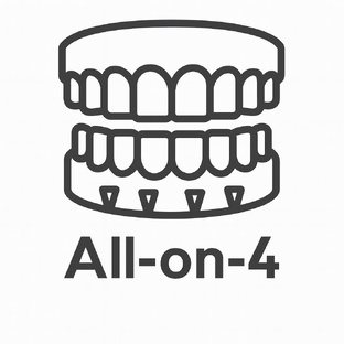 All-on-4