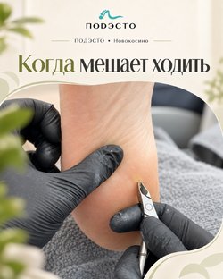 Мозоли и дискомфорт при ходьбе