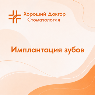 ИМПЛАНТАЦИЯ ЗУБОВ 