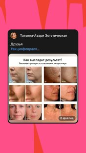 Альтернатива инъекционным методикам