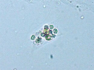 Осадок мочи