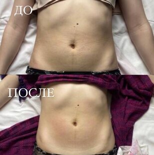 Восстановление 