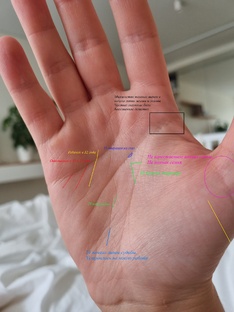 Анализы ладоней