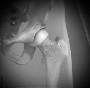 Тазобедренный сустав