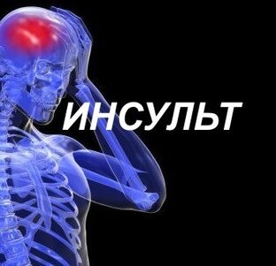 ИНСУЛЬТ