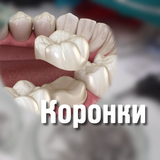 Коронки