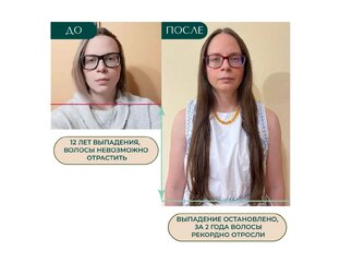 Отзывы на программу «Волосы мечты»