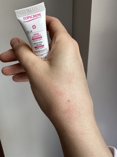 CICA и SOS средства 