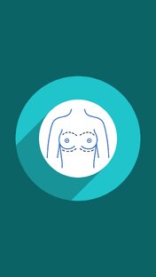 Маммопластика