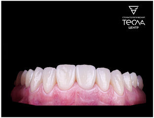 🦷Это поистине прекрасно! 