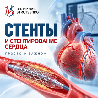 Все про стентирование