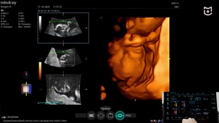 Mindray Imagyn i9 - мастер-классы на УЗИ аппарате