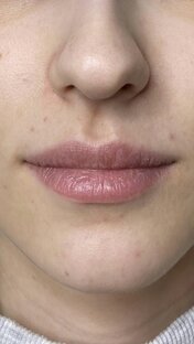 Эстетика Губ