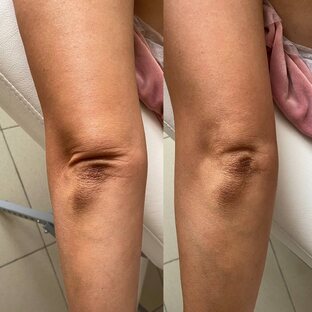 Про локти и колени