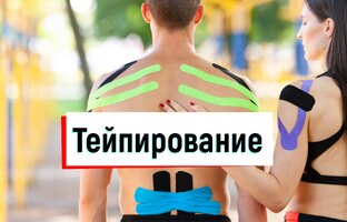 Кинезиотейпирование