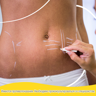 Послеоперационные шрамы: путь пациента