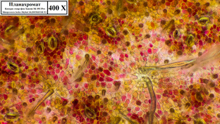 Эпидермисы