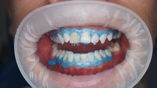 Платные Стоматологические лекции