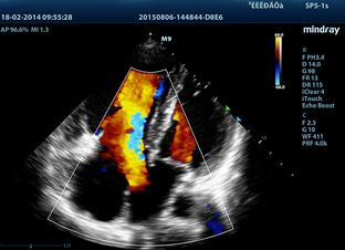 Кинопетли УЗИ-сканера Mindray M9