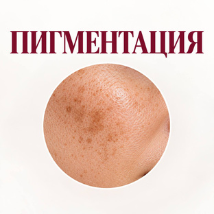 Пигментация , пятна на лице 