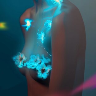 Мастопексия