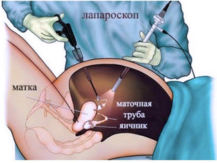 Навыки лапароскопии 