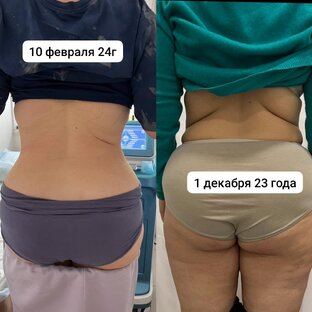 Реальные результаты похудения