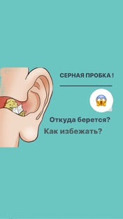 Серные пробки ! Вата в ухе ! Как чистить уши?!