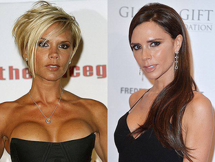 Пластика звёзд: до и после, о чём не говорят вслух