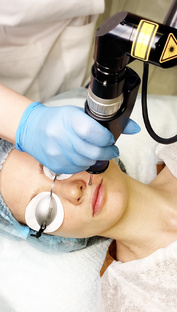 ЛАЗЕРНАЯ ШЛИФОВКА | Москва