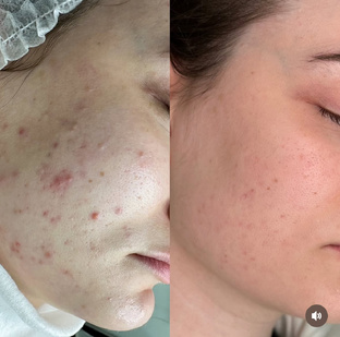 Результаты 2