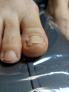 Титановая нить