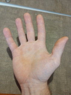 Ремонт на коленке. 