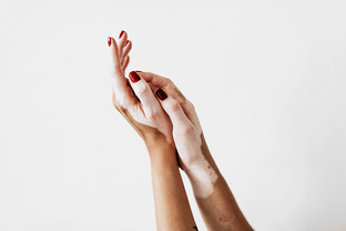 ДЕРМАТОЛОГИЯ