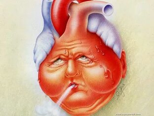 СЕРДЕЧНАЯ НЕДОСТАТОЧНОСТЬ