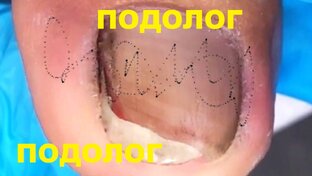 Будьте осторожны