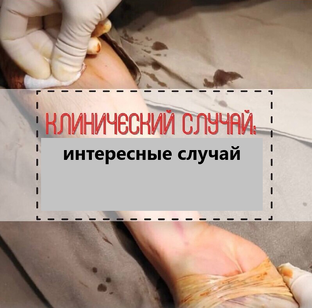 Клинические случай