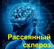 РАССЕЯННЫЙ СКЛЕРОЗ