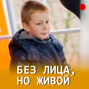 История Вали Королева из Сочи