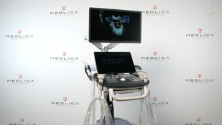 Mindray Consona N8 - мастер-классы на УЗИ аппарате