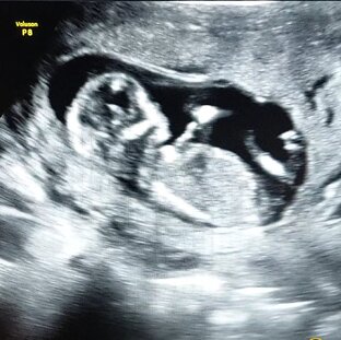 Моя беременность