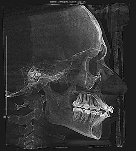 Ортодонтия