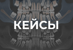 Кейсы
