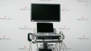 Mindray DC-90 - мастер-классы на УЗИ аппарате